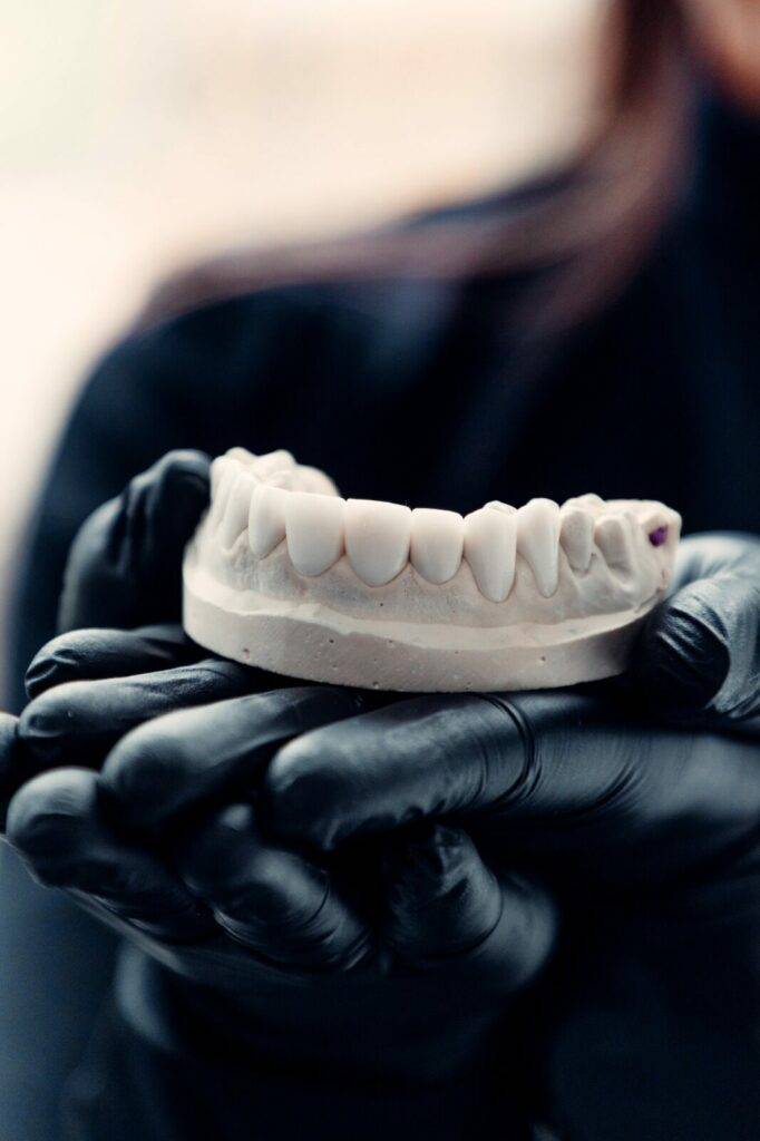 Veneer patient smiling during follow-up — Colombia Care Dental, Medellín