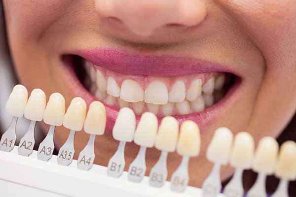 Is a Veneers Smile Makeover in Medellin Colombia Right for You? A smile makeover using dental veneers is a popular cosmetic dentistry...