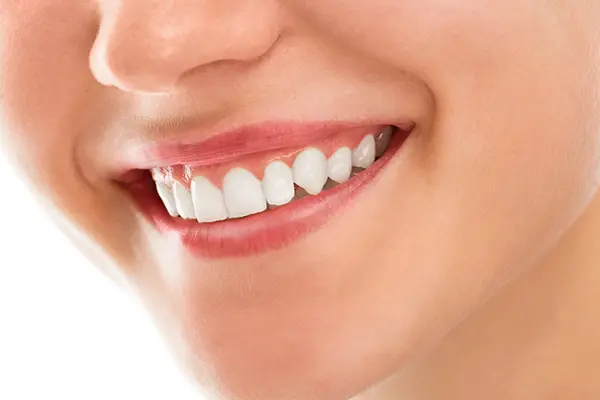 Descubre cómo las carillas en dientes desgastados pueden revitalizar tu sonrisa y mejorar tu salud oral. En Colombia Care Dental, expertos en estética odontológica, te hablaremos en...